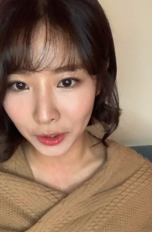 '이창수 결별' 김은영 "보조개 성형 아니에요"