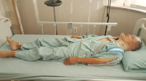 전동킥보드 사고를 입은 A씨 아버지 