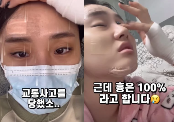 뇌진탕에 얼굴에 붕대 투성이…50만 유튜버 무슨 일?