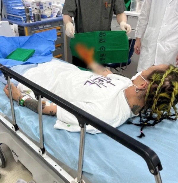 "뼈가 살을 찢고 나왔다" 팝핀현준 근황에 '깜짝'