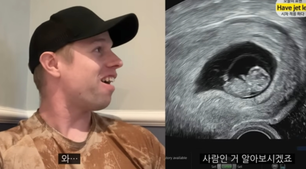 올리버쌤 아내, 유산 후 6개월만에 임신 '감동'