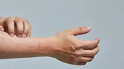 두꺼운 비닐같은 '건선' 증상, 위험한 이유 (+사진주의)