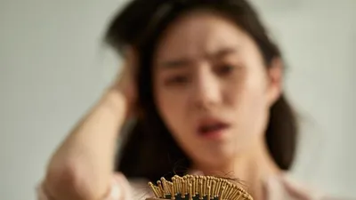"탈모" 악화시키는 생활습관 과 예방법