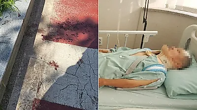 전동킥보드 사고 결국 이런 일이...신도림역 뺑소니 찾는다