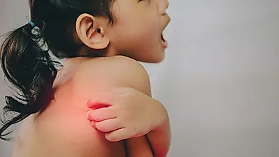 화상 당했을 때 대처 및 예방법...종류는?