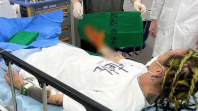 "뼈가 살을 찢고 나왔다" 팝핀현준 근황에 '깜짝'