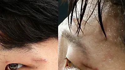 손흥민, 몸 상태 '충격' 상처 점점 심해져 