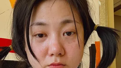 박나래, 긴급 수술로 '환자복' 입은 근황 '충격'