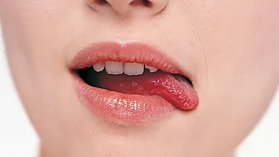 "구술염" 원인과 예방법