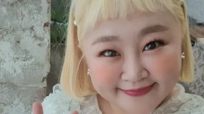 홍윤화, 십자인대 수술 후 근황에 "의사 4명 붙었다"