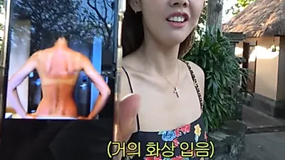 한혜진 상반신이 온통 빨갛게…발리에서 무슨 일?