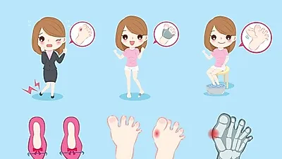 발가락이 휘어지는 "무지외반증" 원인과 증상 예방법