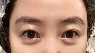 김혜수, 50대에도 주름 하나 없는 아기피부