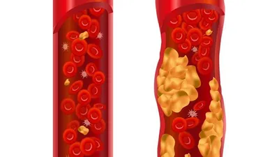 손·발 파랗게 변하는 레이노증후군 발생하는 원인
