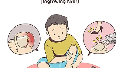 발톱으로 보는 건강 상태