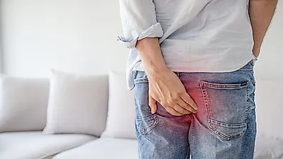 치질과 같은 항문질환이 대장암을 일으킬까?