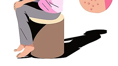 통증까지 발생하는 '대상포진' 치료 및 예방법