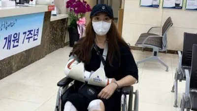 오토바이 사고로 피부 아작났다는 여배우, 근황에…
