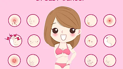 "유방암"을 일으키는 원인 및 예방법