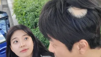 권상우, 벌써 원형탈모? 휑한 정수리에 팬들 '깜짝'