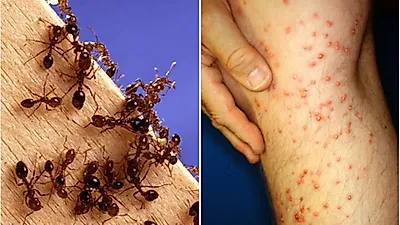 광양항서 발견된 '붉은불개미' 실제 위험성…"물리면 골로 갈수도"