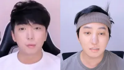 "코 녹아내렸다" 강학두 수술 부작용에 병원장 입장은…