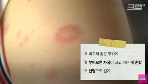 빈대 확인 및 퇴치법 화제 '이것' 있으면 끝장